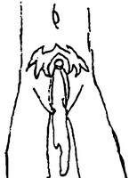 1128842